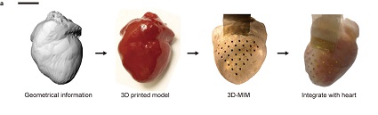 Heart_device_Figure_1a